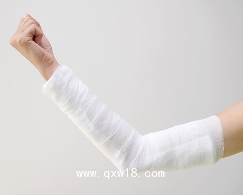 安徽斯麥特醫(yī)用高分子夾板生產(chǎn)廠家