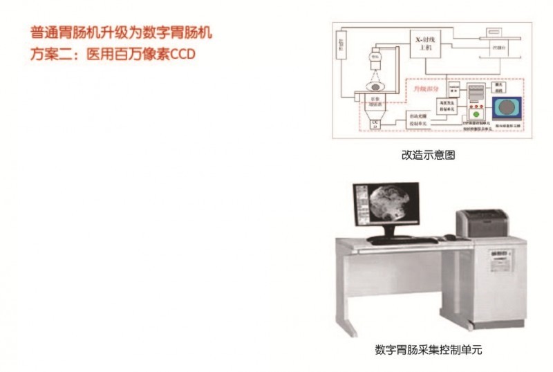 普通胃腸機(jī)升級為數(shù)字胃腸機(jī)