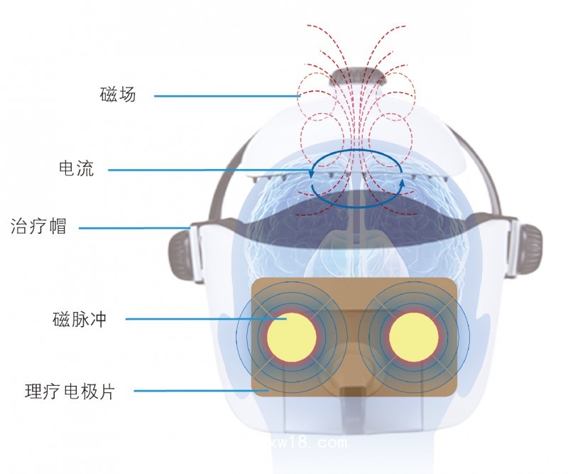 腦循環(huán)功能障礙治療儀