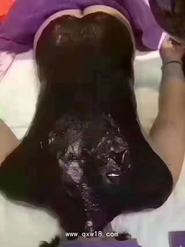 泥灸