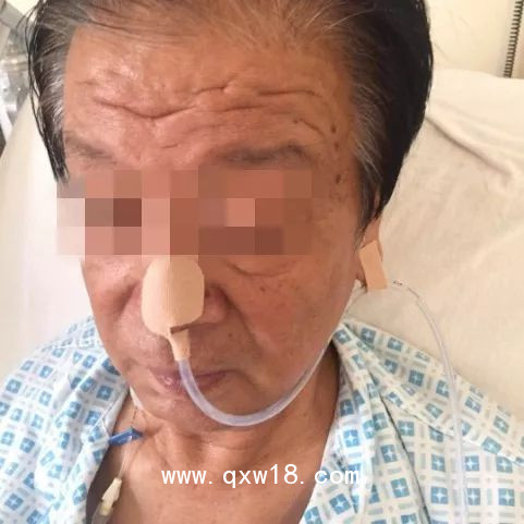 廠家供應(yīng) 鼻胃管貼 強(qiáng)粘高彈力滿涂膠帶 無(wú)殘膠