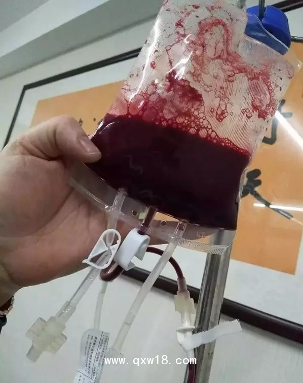 一次性大自血血袋，一次性輸血器，醫(yī)用臭氧儀等耗材產(chǎn)品批發(fā)