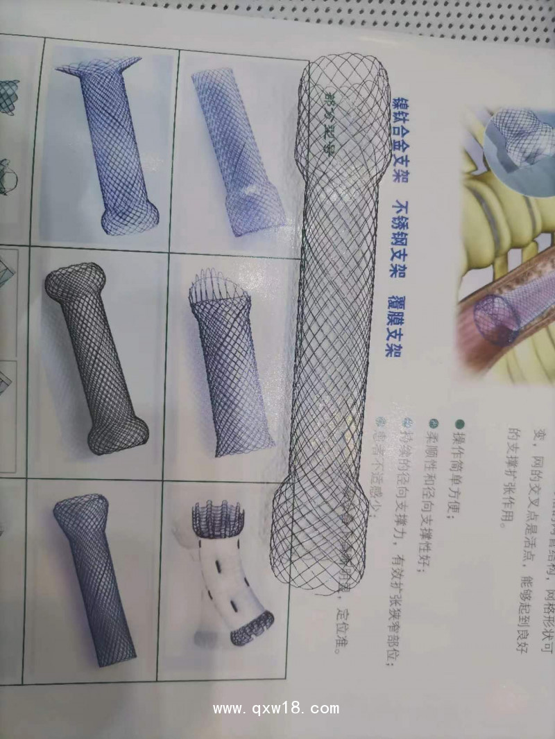 覆膜膽道支架