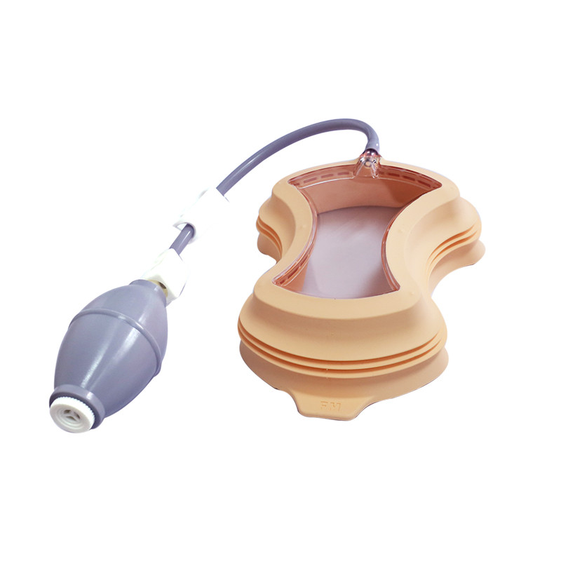 女性漏斗胸矯治器