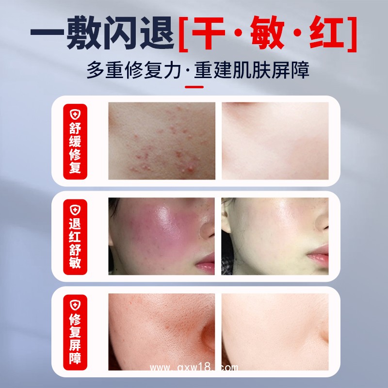 透明質(zhì)酸鈉敷料 二類械字號醫(yī)用面膜 美容院線專供