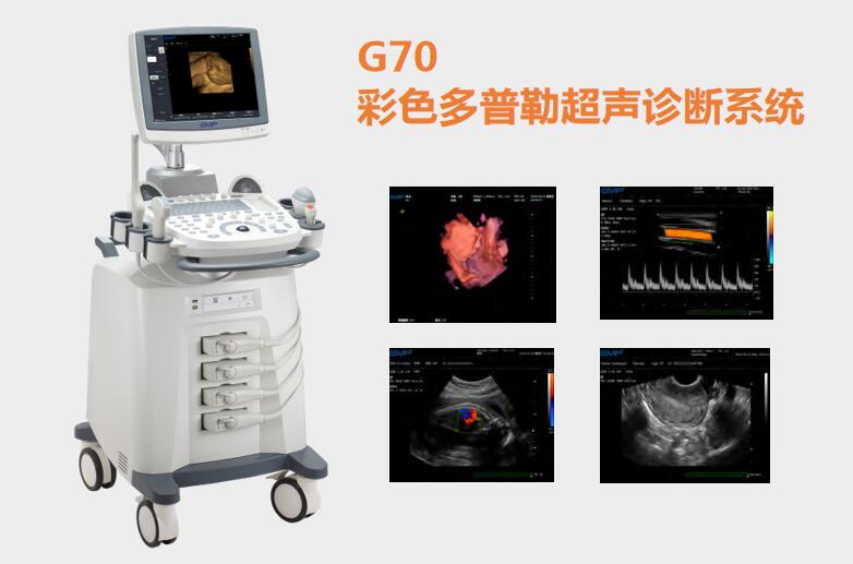 多普勒超聲成像系統(tǒng)