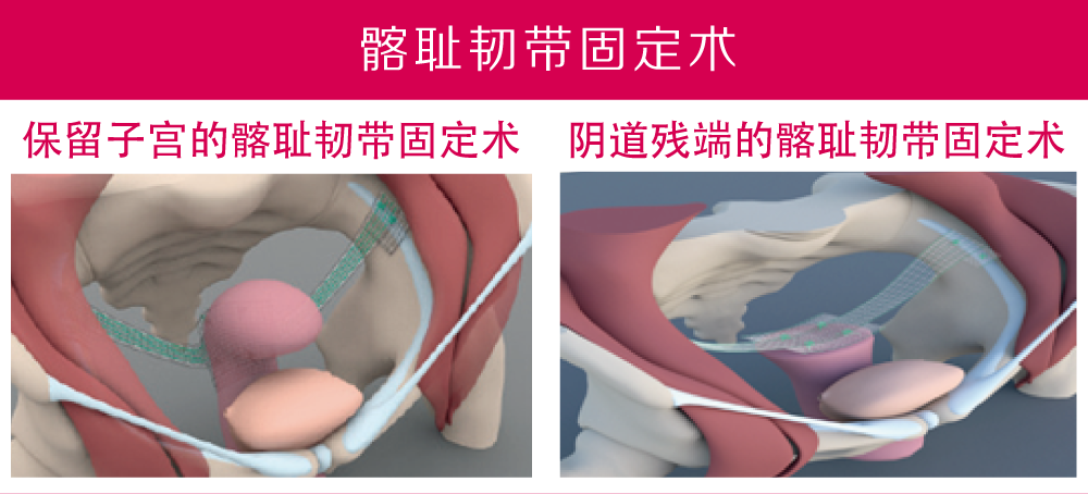 未標(biāo)題-2.png